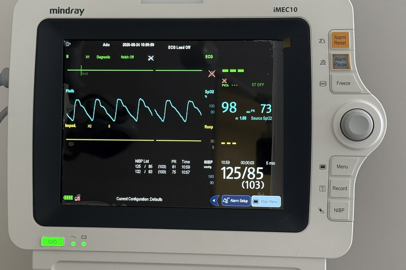 미루나무치과에서 진정 중 사용하는 마인드레이 iMEC10 환자감시장치 화면 — 산소포화도 98%, 맥박 73회, 혈압 125/85